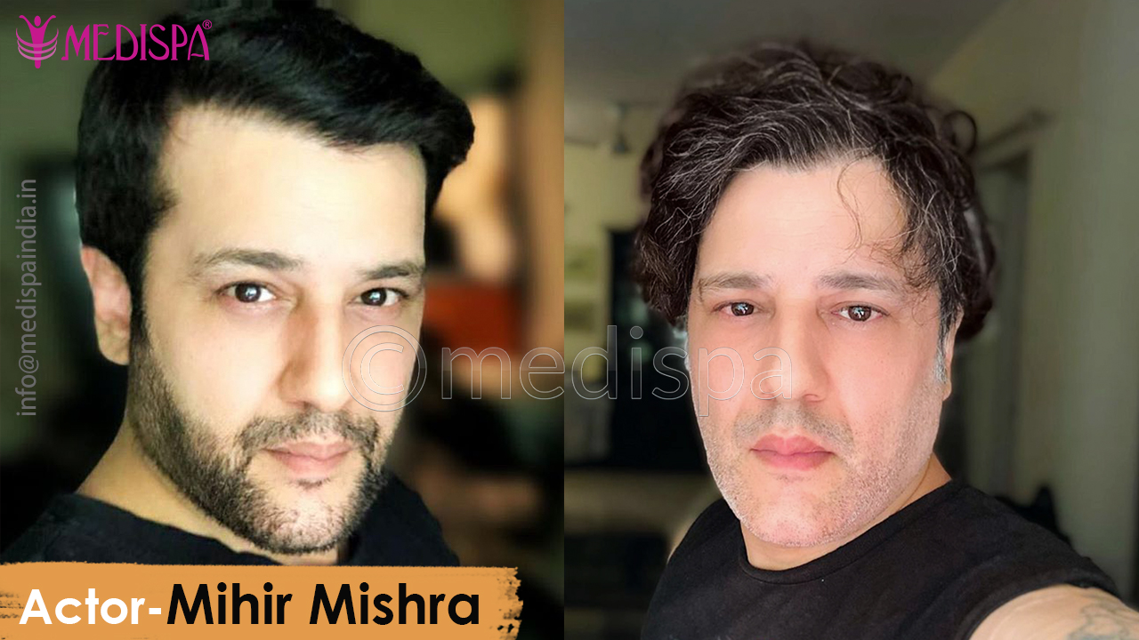 best Celebrity actor Mihir Mishra result