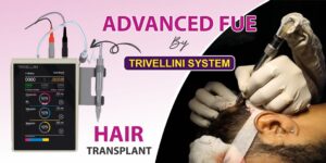 Explain The Significance Of Advanced FUE Hair Transplant