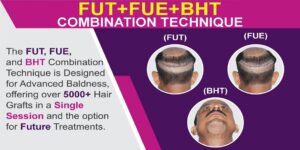 How Does FUE+FUT+BHT Hair Transplant Technique Is Better Than Other Methods?