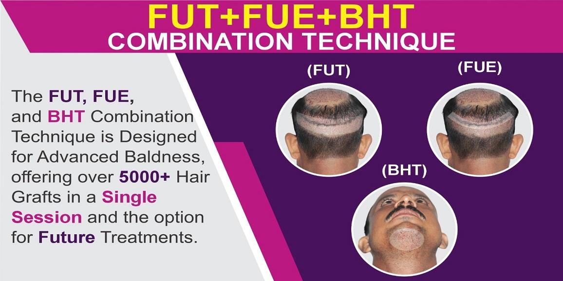 How Does FUE+FUT+BHT Hair Transplant Technique Is Better Than Other Methods?